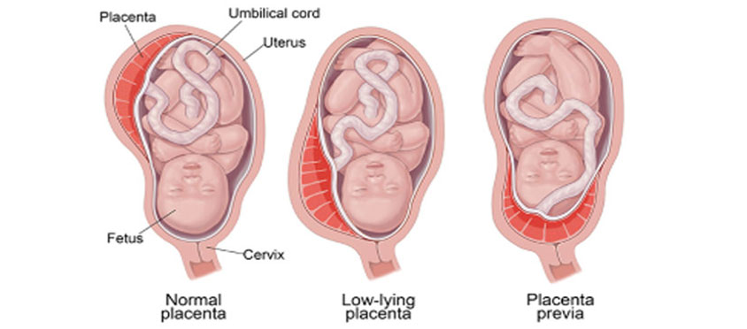 Introduction to the 3 Stages of Labour