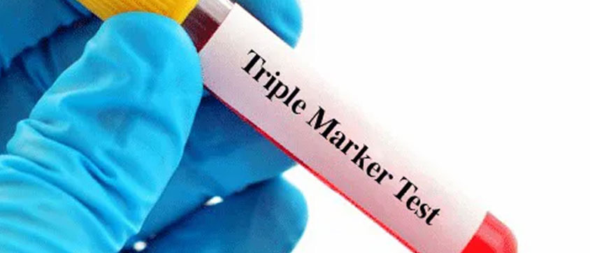 Triple Marker Pregnancy Test