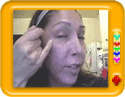 Laser treatment for acne