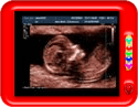 Ultrasound in 12th Week