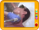 Laser Hair Removal for Men
