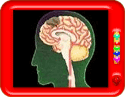 What is a brain stroke