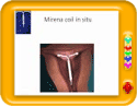Preventing Unplanned Pregnancy