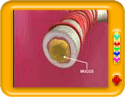 What is Asthma?