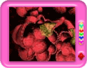 What is pneumonia?