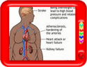 Prevent obesity, live longer