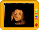 Baby in Ultrasound