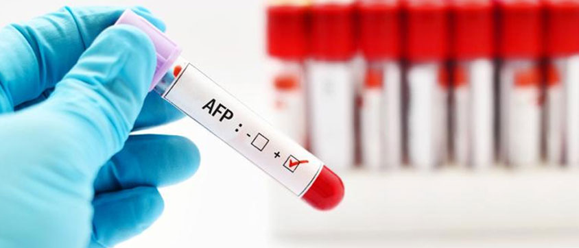 Alpha Feto-protein (AFP)