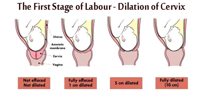 The First Stage of Labour - Dilation of Cervix - India Parenting