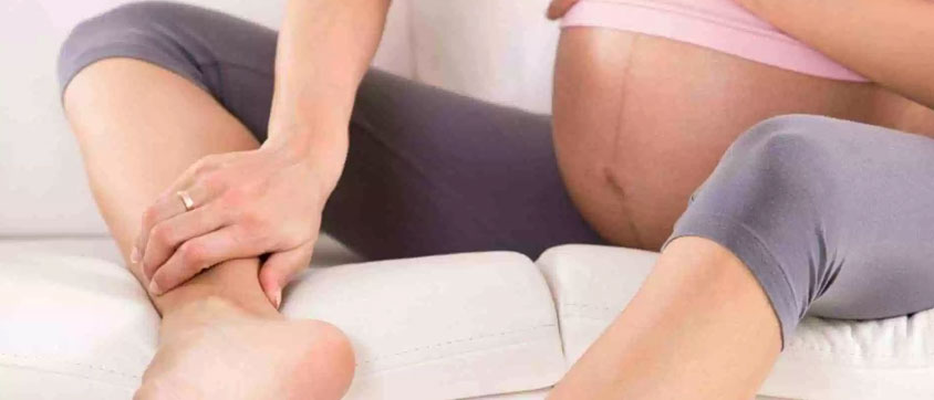 Varicose Veins