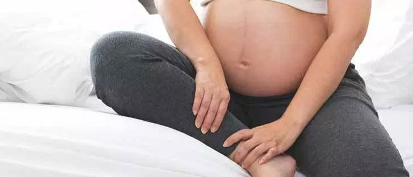 Varicose Veins Prevention in Pregnant Women