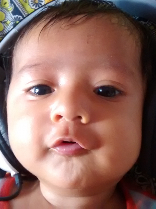 Adyant