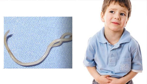 Pinworm Infection in Children
