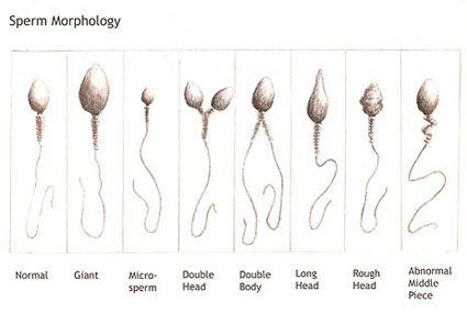 Motility Range Chart