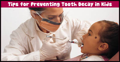 Preventing Tooth Decay