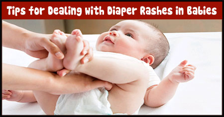 Coping with Diaper Rashes in Babies