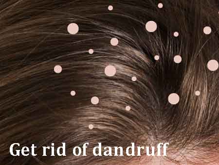 Get rid of dandruff