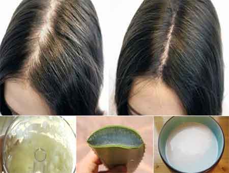 Home Remedies to Control Hair Fall  Zorg Health