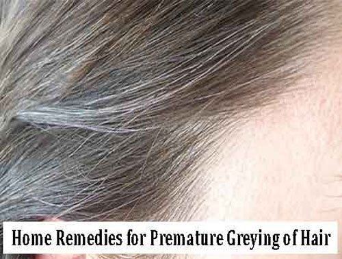 Home Remedies for Premature Greying of Hair Home Remedies for Premature Greying of Hair