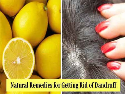 Home Treatments for Dandruff  How to Treat Dandruff at Home  Hair Care  Tips  Home Remedies  YouTube