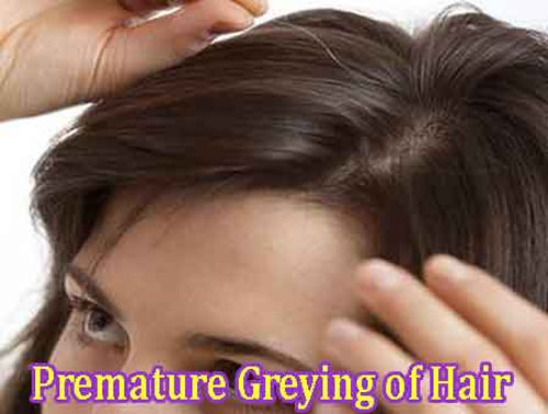 Premature Greying of Hair