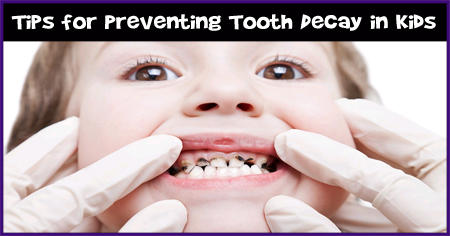 Tips for Preventing Tooth Decay in Kids