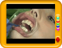 Getting Braces