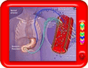 What is type 1 diabetes